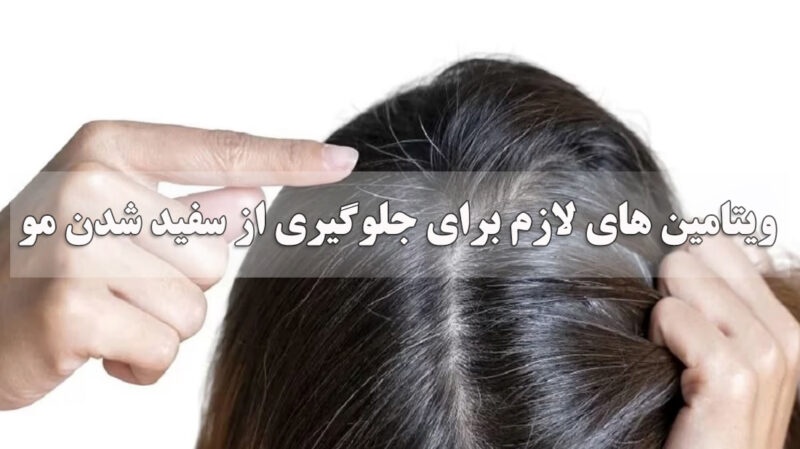 برای جلوگیری از سفید شدن مو چه قرص و ویتامینی بخوریم؟