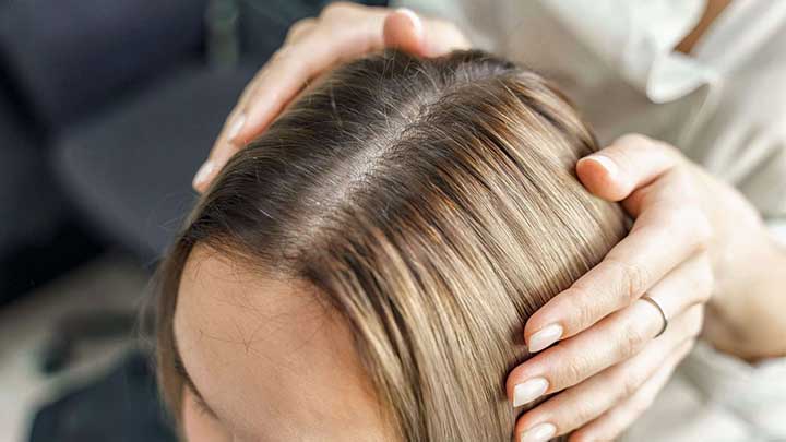 نکات مهم در مصرف شامپوهای ضد ریزش مو