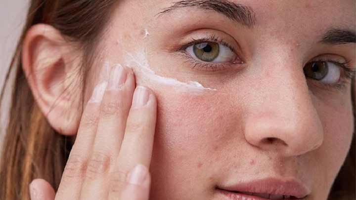 تاثیر ضد آفتاب بر جوش صورت